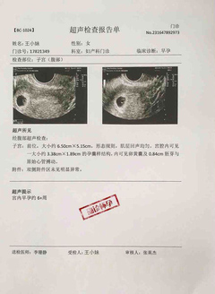 怀孕超声检查报告单